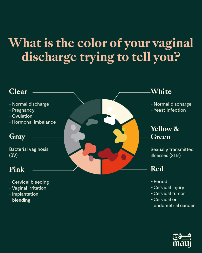 illustration titled: what's the color of your vaginal discharge trying to tell you?".